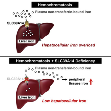 What is Hemochromatosis?