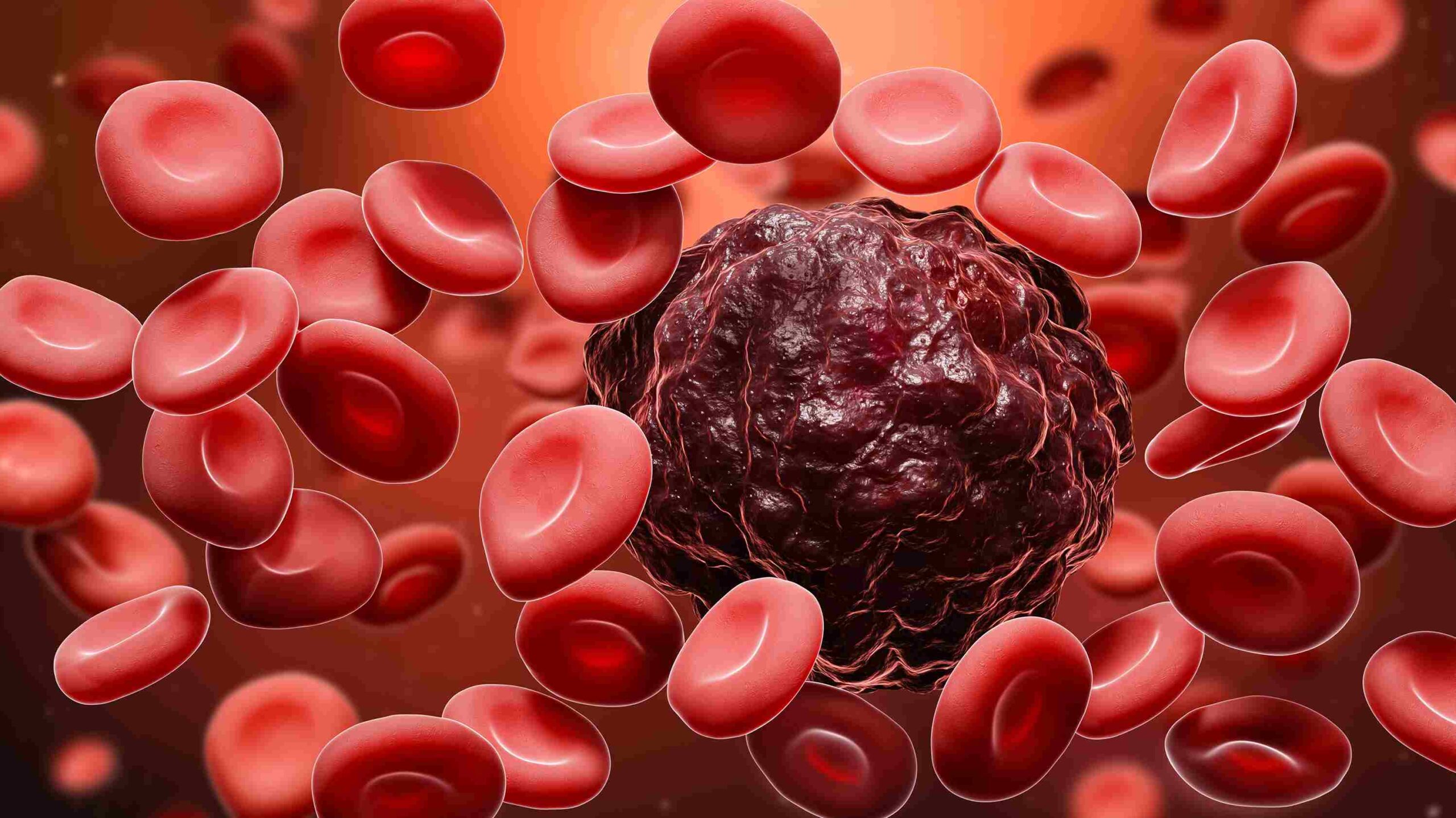 What is Blood cancer?